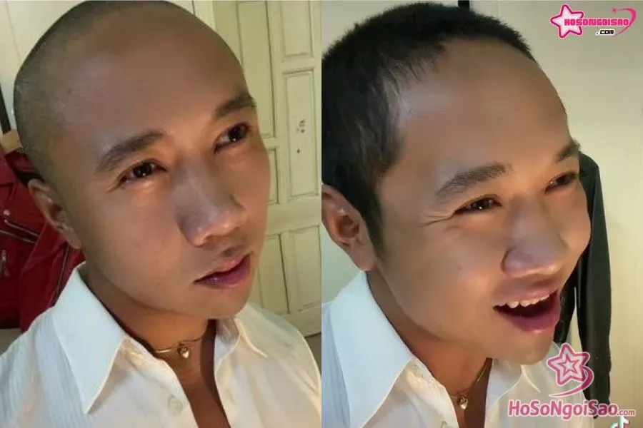 Bệu bé bỏng